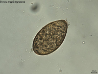 vajíčko Fascioloides magna (materiál poskytnut PřF UK)